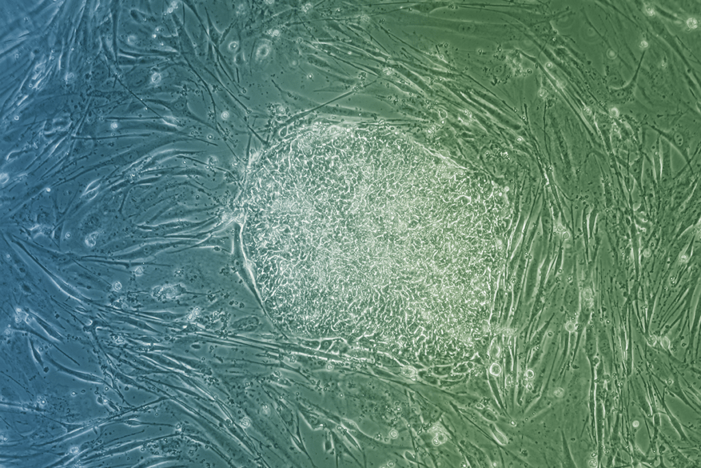 Visuel représentant une cellule vue au microscope. Il s'agit de la vignette des cours de biologie cellule d'ULB HeLSci